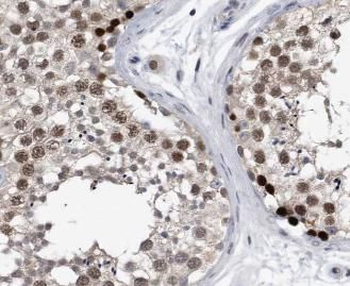 APOBEC3G Rabbit Polyclonal Antibody