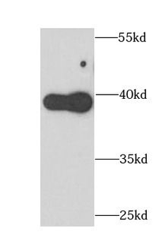 APOL1 Rabbit Polyclonal Antibody
