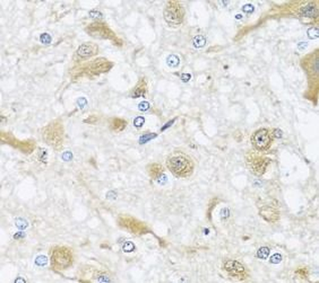 APOL1 Rabbit Polyclonal Antibody