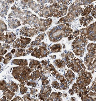 APOA1 Rabbit Polyclonal Antibody