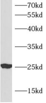 APOM Rabbit Polyclonal Antibody