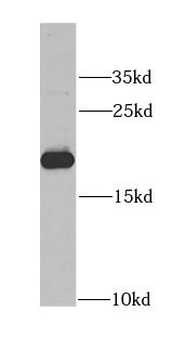 APRT Rabbit Polyclonal Antibody