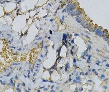 APRT Rabbit Polyclonal Antibody