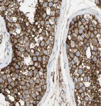 ARCN1 Rabbit Polyclonal Antibody