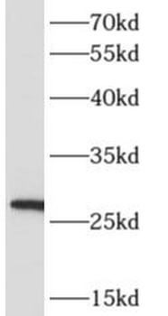ARD1A Rabbit Polyclonal Antibody