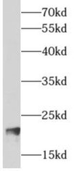 ARF3 Rabbit Polyclonal Antibody