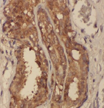 ARF3 Rabbit Polyclonal Antibody