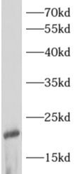 ARF3 Rabbit Polyclonal Antibody
