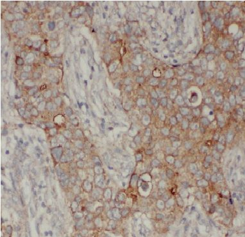 ARF3 Rabbit Polyclonal Antibody