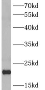 ARF4 Rabbit Polyclonal Antibody