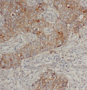 ARF4 Rabbit Polyclonal Antibody