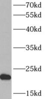 ARF5 Rabbit Polyclonal Antibody