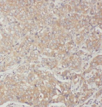 ARF5 Rabbit Polyclonal Antibody