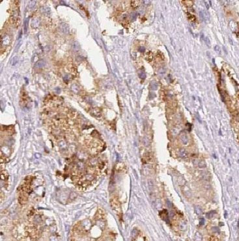 ARFGAP1 Rabbit Polyclonal Antibody