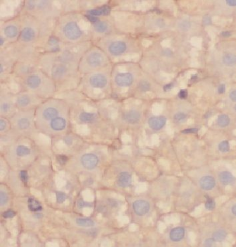 ARFIP2 Rabbit Polyclonal Antibody