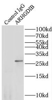ARHGDIB Rabbit Polyclonal Antibody