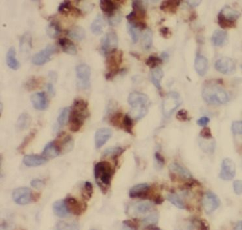 ARHGDIB Rabbit Polyclonal Antibody