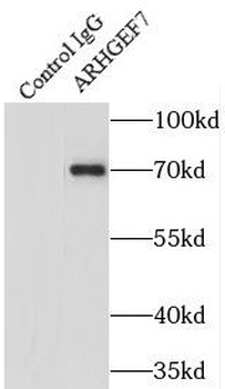 ARHGEF7 Rabbit Polyclonal Antibody