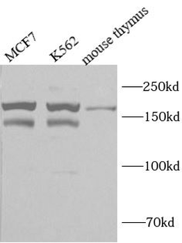 ARID4B Rabbit Polyclonal Antibody