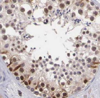 ARID4B Rabbit Polyclonal Antibody