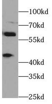 ARL13B Antibody