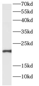 ARL2BP Rabbit Polyclonal Antibody