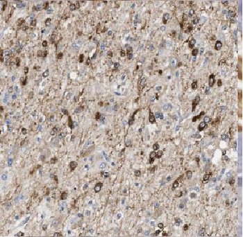 ARL2BP Rabbit Polyclonal Antibody