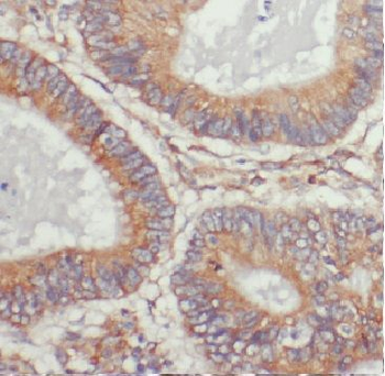 ARL4C Rabbit Polyclonal Antibody