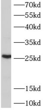 ARL6IP6 Rabbit Polyclonal Antibody