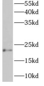ARL6IP1 Rabbit Polyclonal Antibody