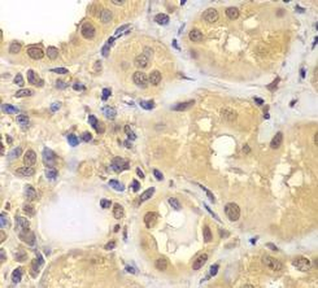 ARNT2 Rabbit Polyclonal Antibody