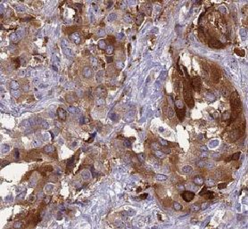 BMAL1 Rabbit Polyclonal Antibody