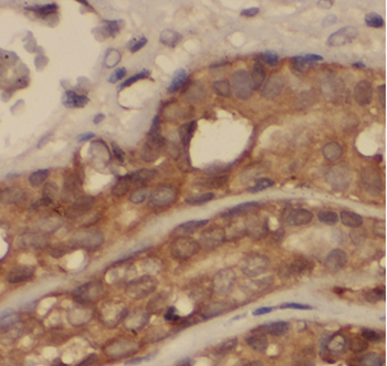 ARPC1B Rabbit Polyclonal Antibody
