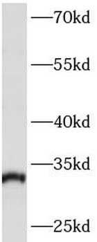 ARPC2 Rabbit Polyclonal Antibody