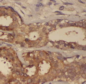 ARPC2 Rabbit Polyclonal Antibody