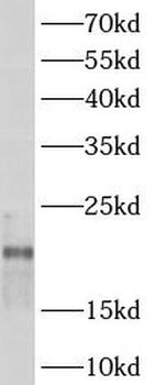 ARPC3 Rabbit Polyclonal Antibody