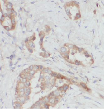 ARPC4 Antibody