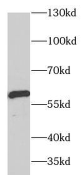 ARSA Rabbit Polyclonal Antibody