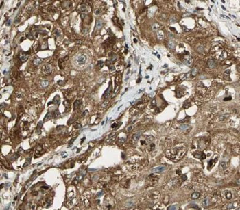 ARSA Rabbit Polyclonal Antibody