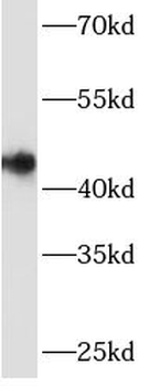ARSB Rabbit Polyclonal Antibody