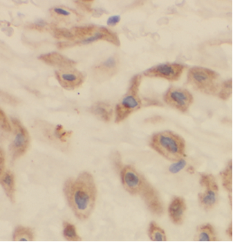 ARSB Rabbit Polyclonal Antibody