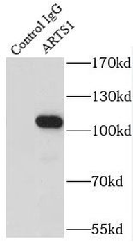 ERAP1 Rabbit Polyclonal Antibody