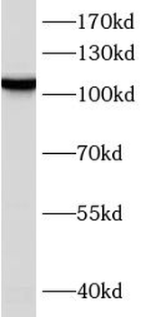 ERAP1 Rabbit Polyclonal Antibody