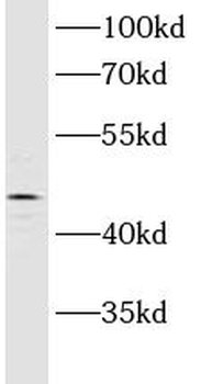 ASCC1 Rabbit Polyclonal Antibody