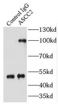 ASCC2 Rabbit Polyclonal Antibody