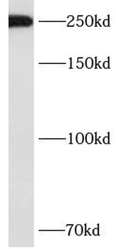 ASCC3 Rabbit Polyclonal Antibody