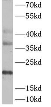 ASF1A Rabbit Polyclonal Antibody