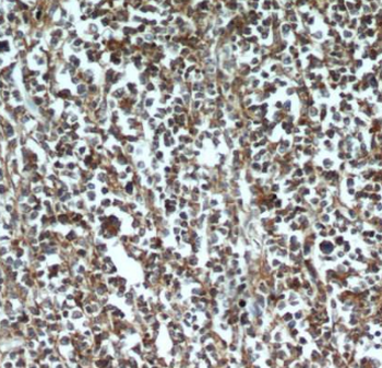 ASF1A Rabbit Polyclonal Antibody