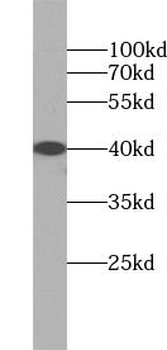 ASGR1 Antibody