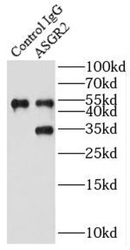 ASGR2 Rabbit Polyclonal Antibody